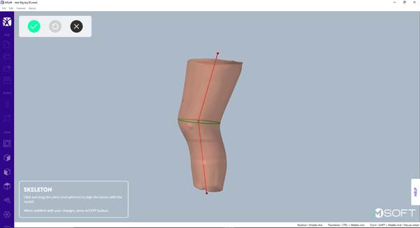 A 3d model of a knee

AI-generated content may be incorrect.