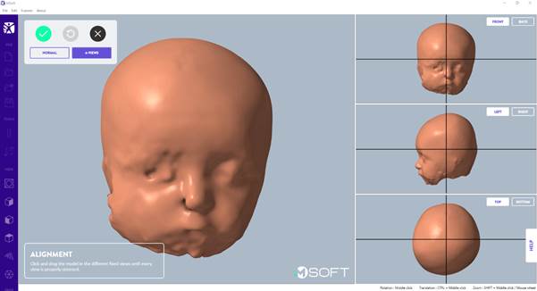 A baby's head and a baby's face

AI-generated content may be incorrect.