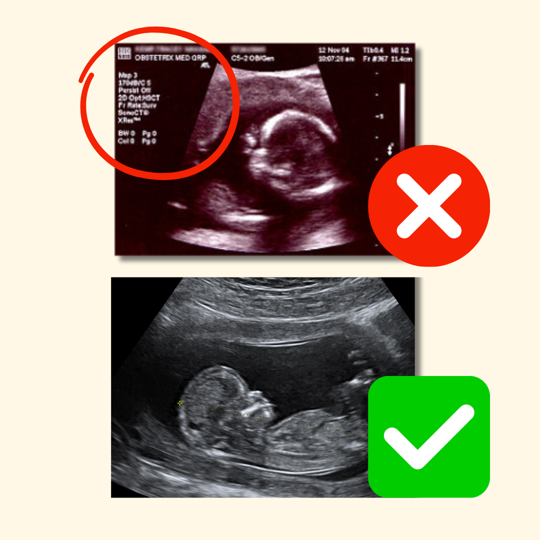 Sonogram with identifying information and without